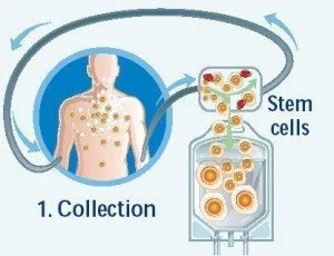 harvested-peripheral-blood-stem-cells