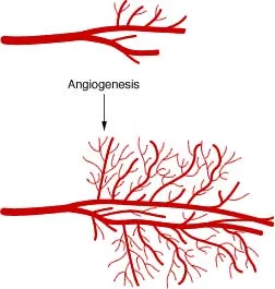 angiogenesis-thai-medical-vacation