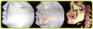 3D Dental Ct Scan Thailand