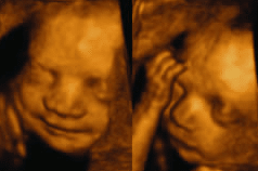 3d-baby-scan