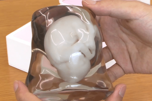 3d-fetus-pgd-thailand