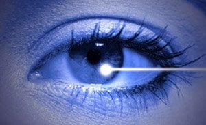 Cataract-treatment-femtosecond-laser-Surgery