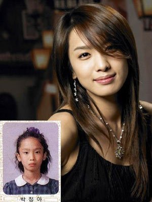asian-korean-Plastic-surgery-before-after