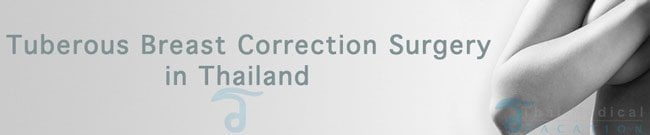 Cosmeditour Thailand - 💕👩‍⚕️ Did you know CosMediTour Surgeons specialise  in Tuberous Breast Correction 👨‍⚕️💕 What are Tuberous Breasts? What  surgery corrects Tuberous Breast? 📖 READ our BLOG 'Breast Surgery for  Tuberous