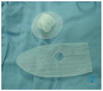 Hernia-synthetic-mesh-before-after-thailand