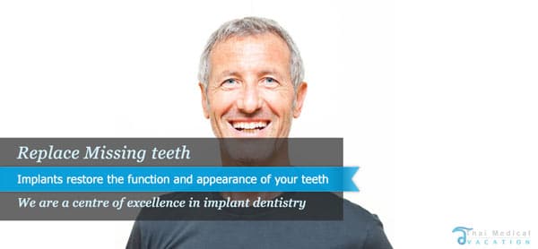 dental-implants-thailand-before-after