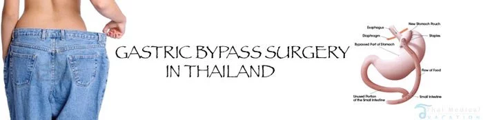 gastric-bypass-surgery-thailand