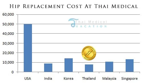hip-replacement-cost-comparison-tmv