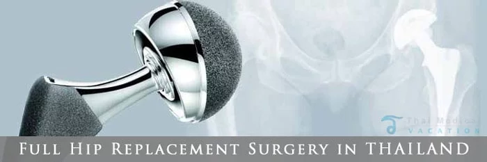 total-hip-surgery-replacement-costs-thailand