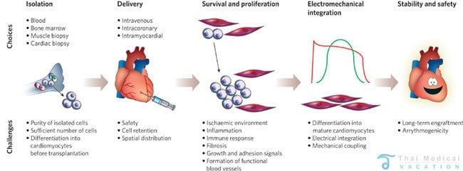 heart-stem-cell-therapy