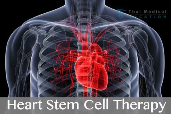 heart-stem-cell-transplants